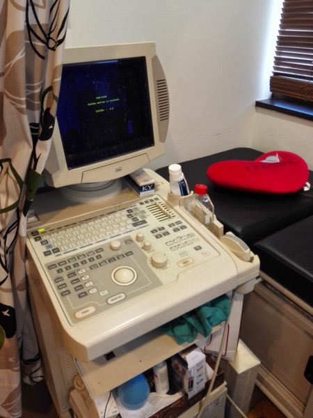 Ultra Sound Scan untuk memeriksa ginjal 